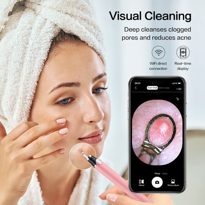 Smart Visual Pimple Pin Blackhead Pore Cleaning Instrument