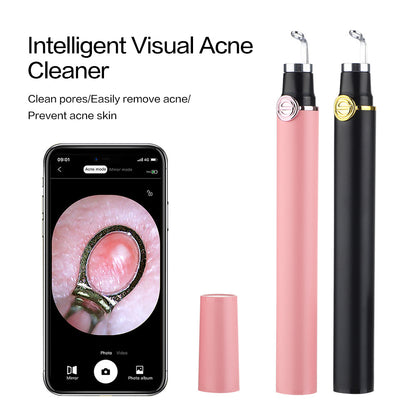 Smart Visual Pimple Pin Blackhead Pore Cleaning Instrument