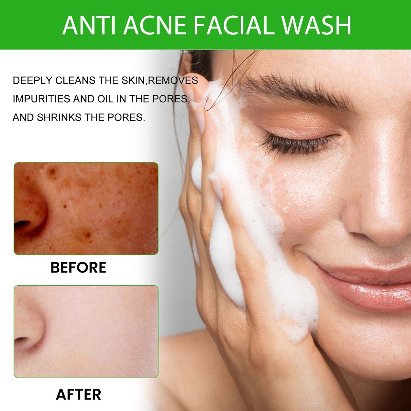 Acne Facial Cleanser Deep Cleansing Grease