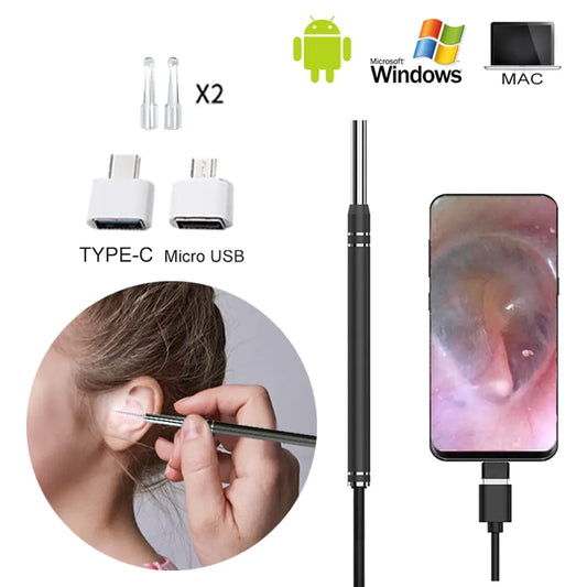 Smart Earwax Removal Tool w/ Camera - Eloy Royal