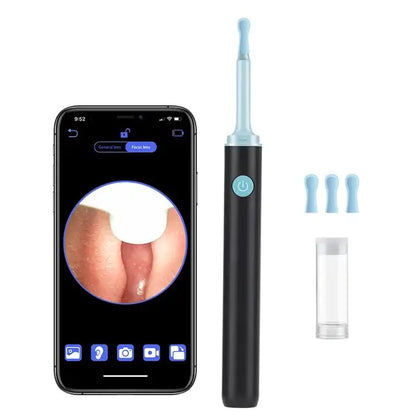 Smart Visual Ear Cleaner - Eloy Royal