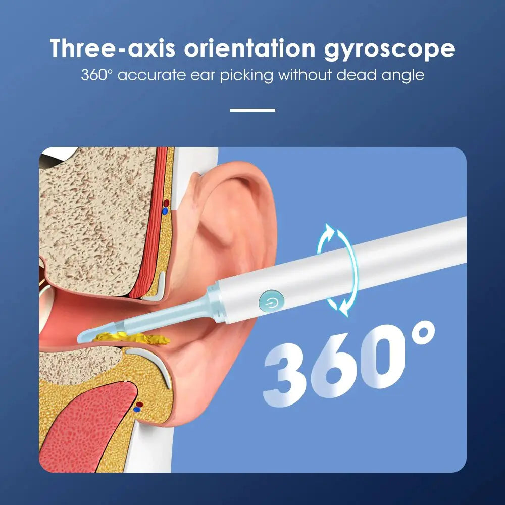 Smart Visual Ear Cleaner - Eloy Royal