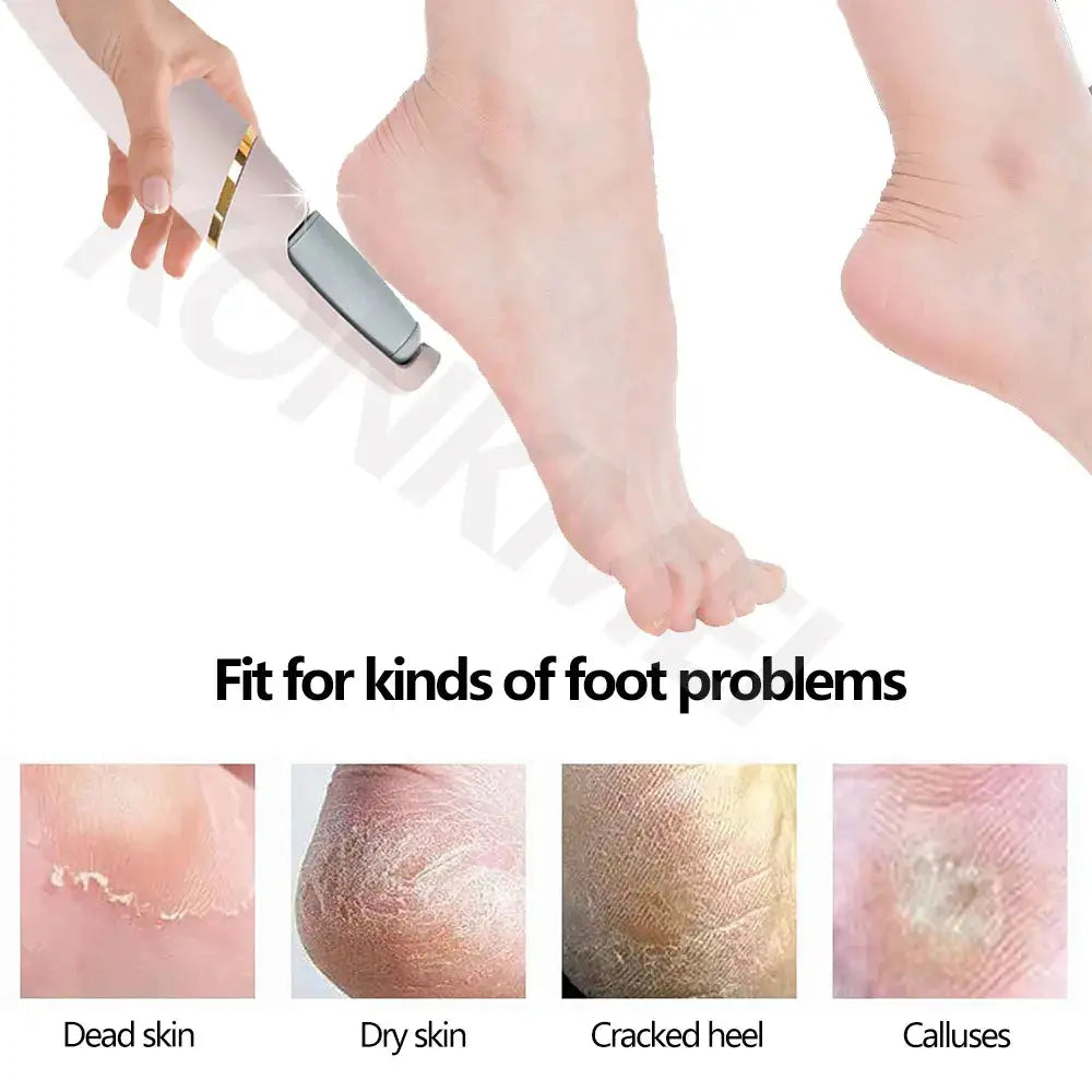 VelvetStep Foot Exfoliator - Eloy Royal