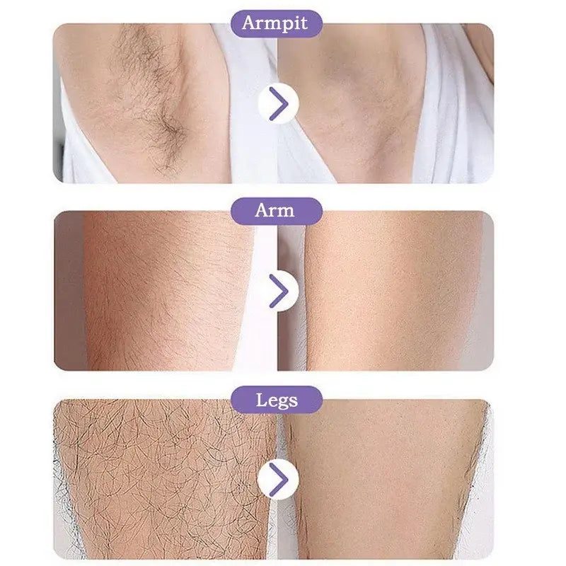 Crystal Epil Hair Removal - Eloy Royal