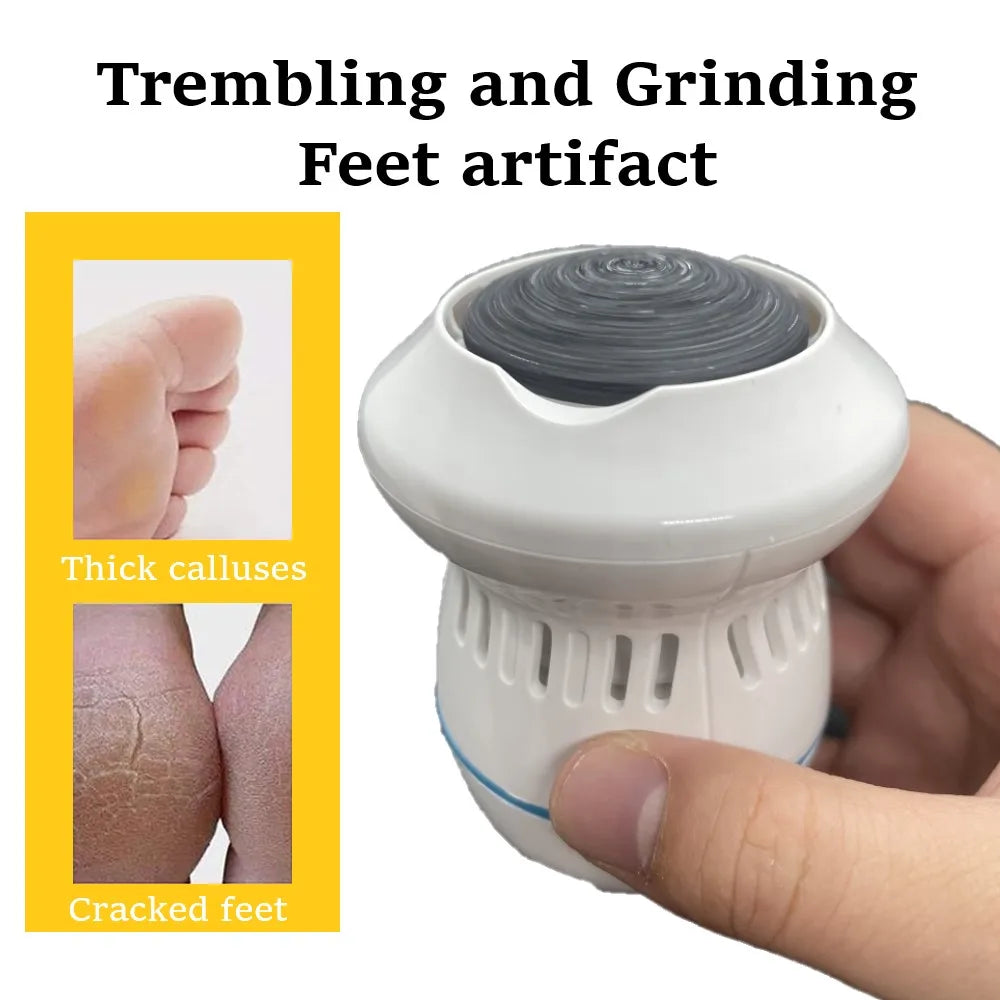 Vacuum Callus Remover - Eloy Royal